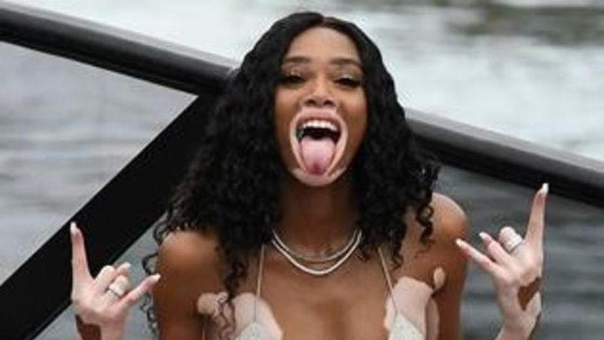 Winnie Harlow celebra sus 24 años en Miami