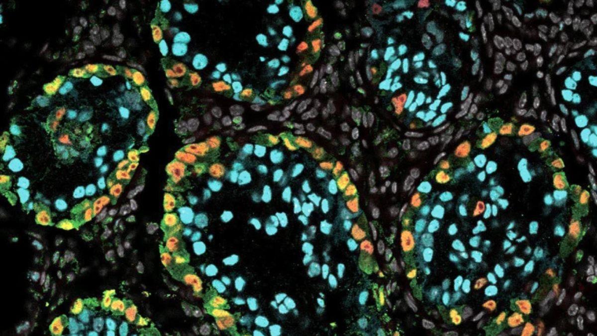 Los investigadores mezclaron células no reproductivas de testículos de ratón (cian) con espermatozoides inmaduros de macaco (rojos y verdes) y las trasplantaron a una bolsa en un riñón de ratón. Un mes después del trasplante, las células del ratón se habían dispuesto en estructuras tubulares como las de los testículos.