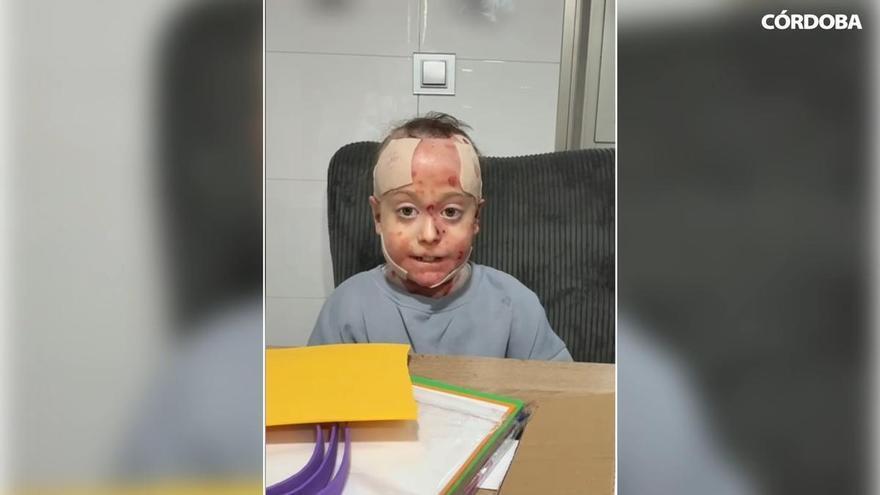 Mariví, madre de una niña cordobesa con piel de mariposa: "Fue una agradable sorpresa conocer que Andalucía aprueba financiar el medicamento"