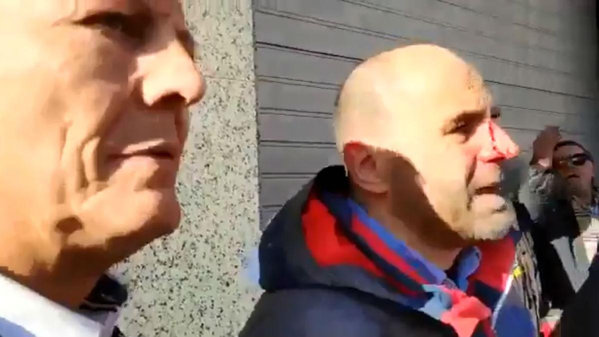 El concejal de Ciudadanos en Blanes Sergio Atalaya, tras ser agredido en Torroella de Montgrí.