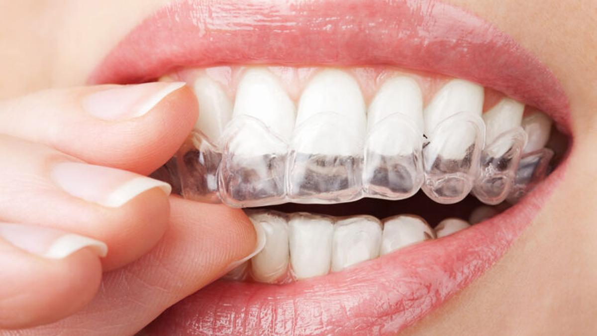 Los síntomas del bruxismo y los peligros del ‘rechinar de dientes’