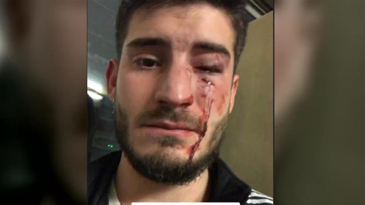 El joven que fue agredido en el metro, en una la imagen que él mismo subió a Twitter. El joven que fue agredido en el metro, en una la imagen que él mismo subió a Twitter.