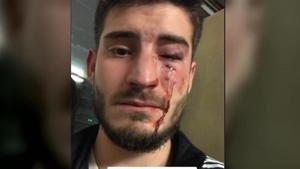 El joven que fue agredido en el metro, en una la imagen que él mismo subió a Twitter.