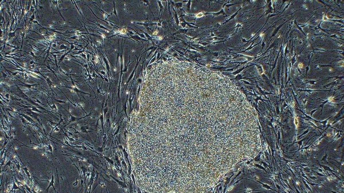 AVANCE MEDICINA | Japón da luz verde a la comercialización de los primeros medicamentos con células iPS
