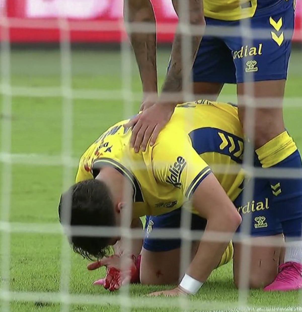 La sangre en la cabeza de Mika Mármol tras su segundo gol