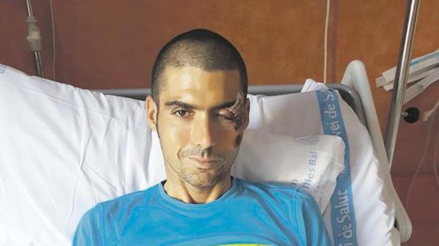 El triatleta Carlos López sufre un atropello en Binissalem