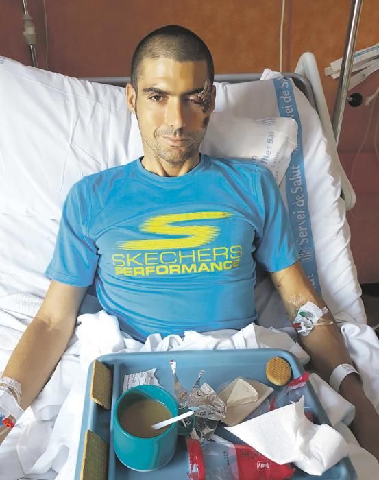 El triatleta Carlos López sufre un atropello en Binissalem