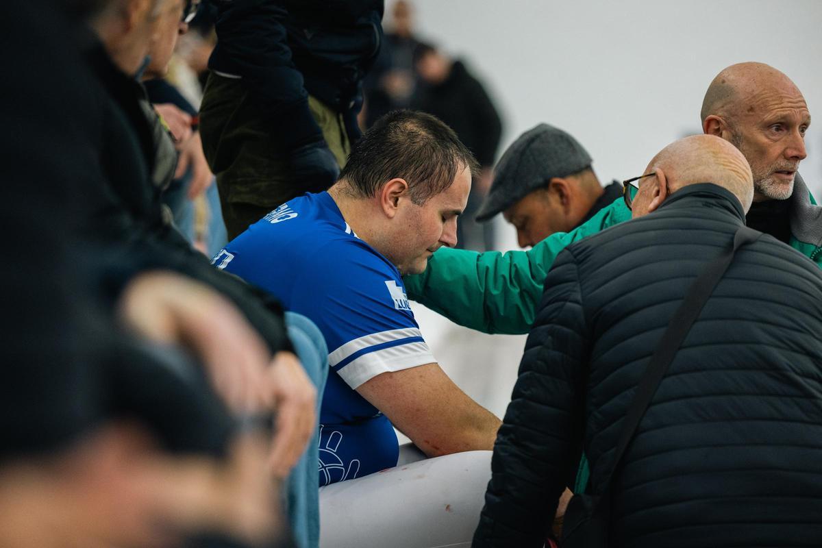 Guillermo, afectat per la pilotada a l'ull que li va impedir continuar jugant..jpg