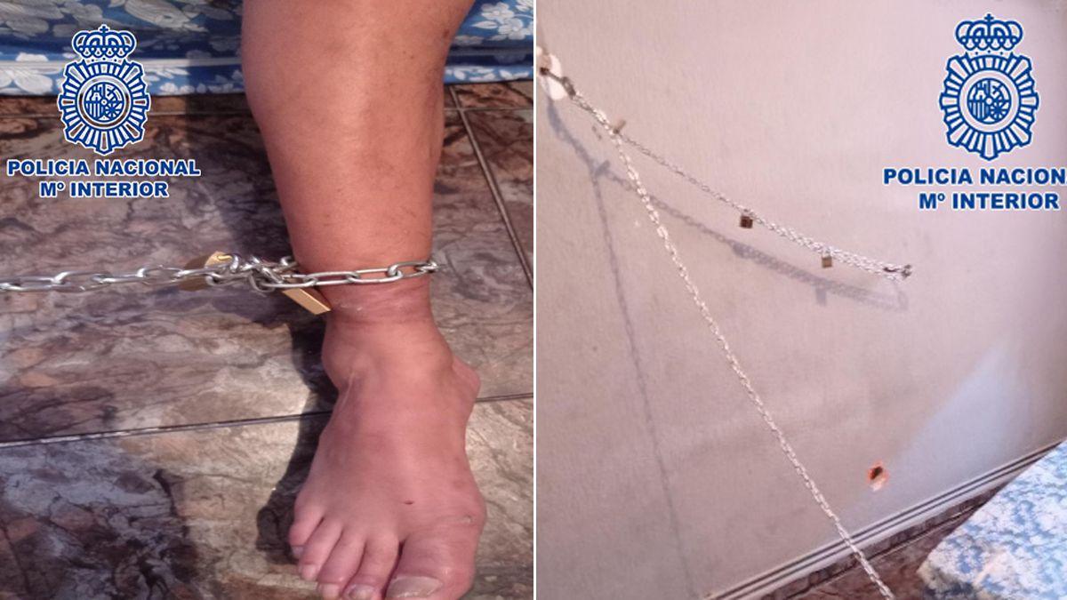 Detalles de las cadenas y del pie de una de las personas retenidas.