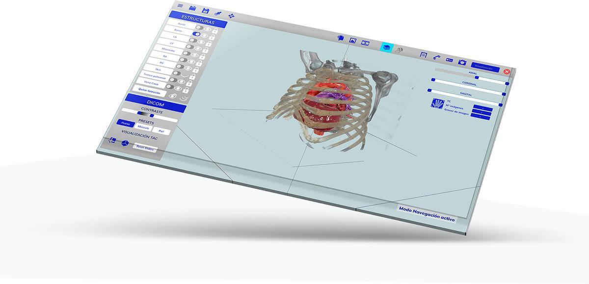 Fluxus, es el software médico desarrollado por Avamed Synergy y asistido por Inteligencia Artificial (IA) que ayuda a anticipar la dinámica tumoral,
