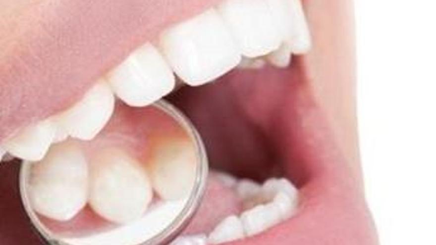 ¿Qué es la periodontitis?