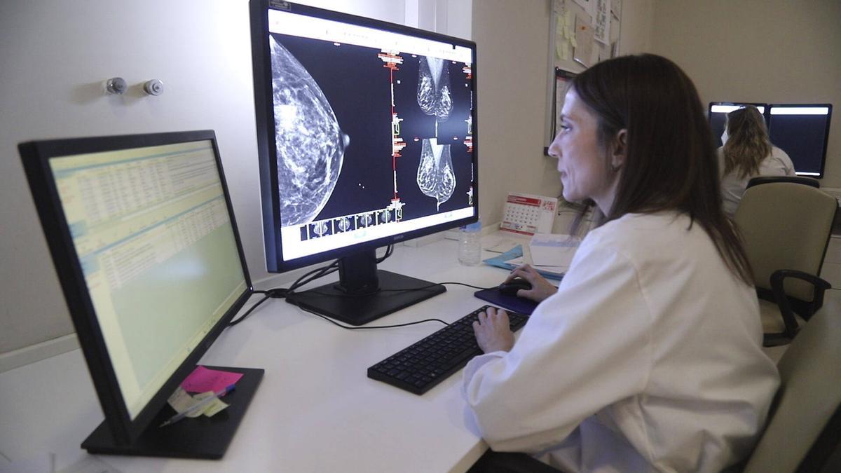 La especialista en Radiodiagnóstico del hospital Reina Sofía, Sara Romero.