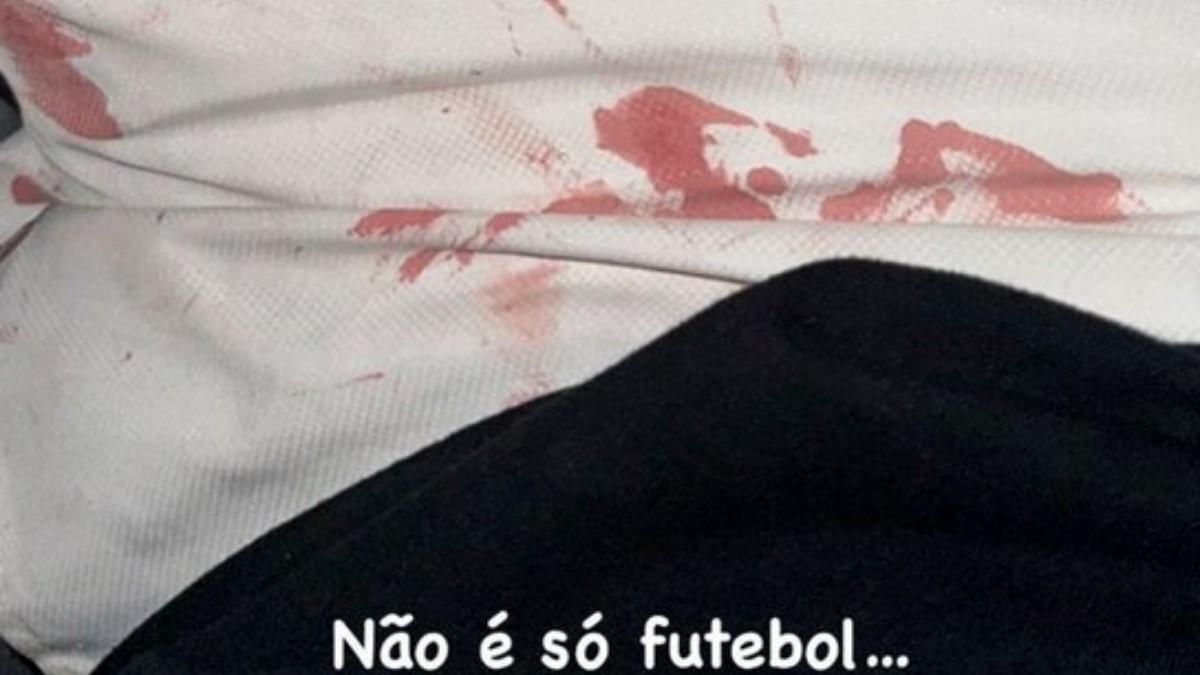 Luan compartió en sus redes secuelas de la agresión