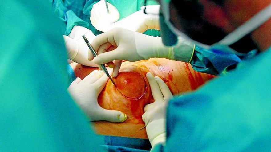 Operación del tumor y reconstrucción con tejido propio