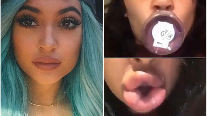 Kylie Jenner presume de labios carnosos.