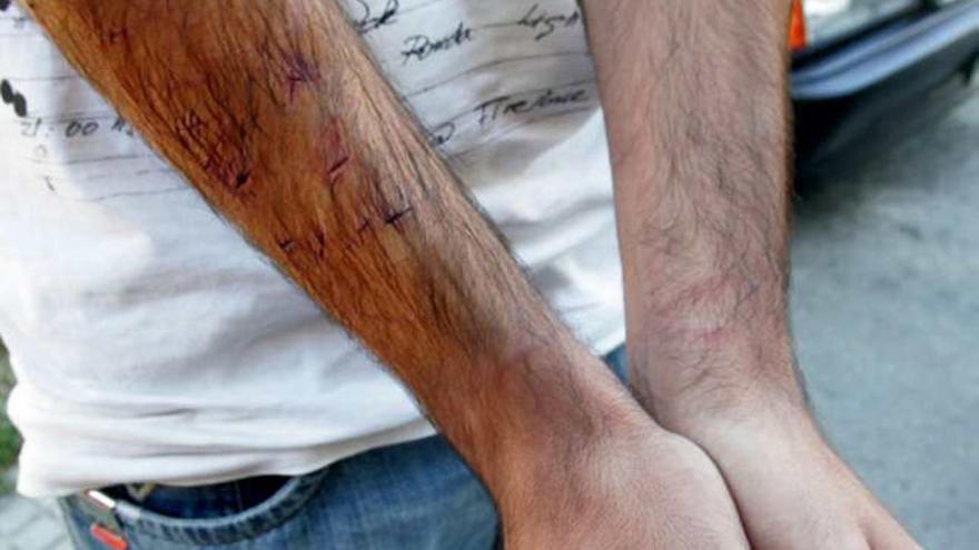 La víctima presentaba ayer varios cortes en el brazo derecho que le hicieron después de darle un golpe cuando salió del ascensor.