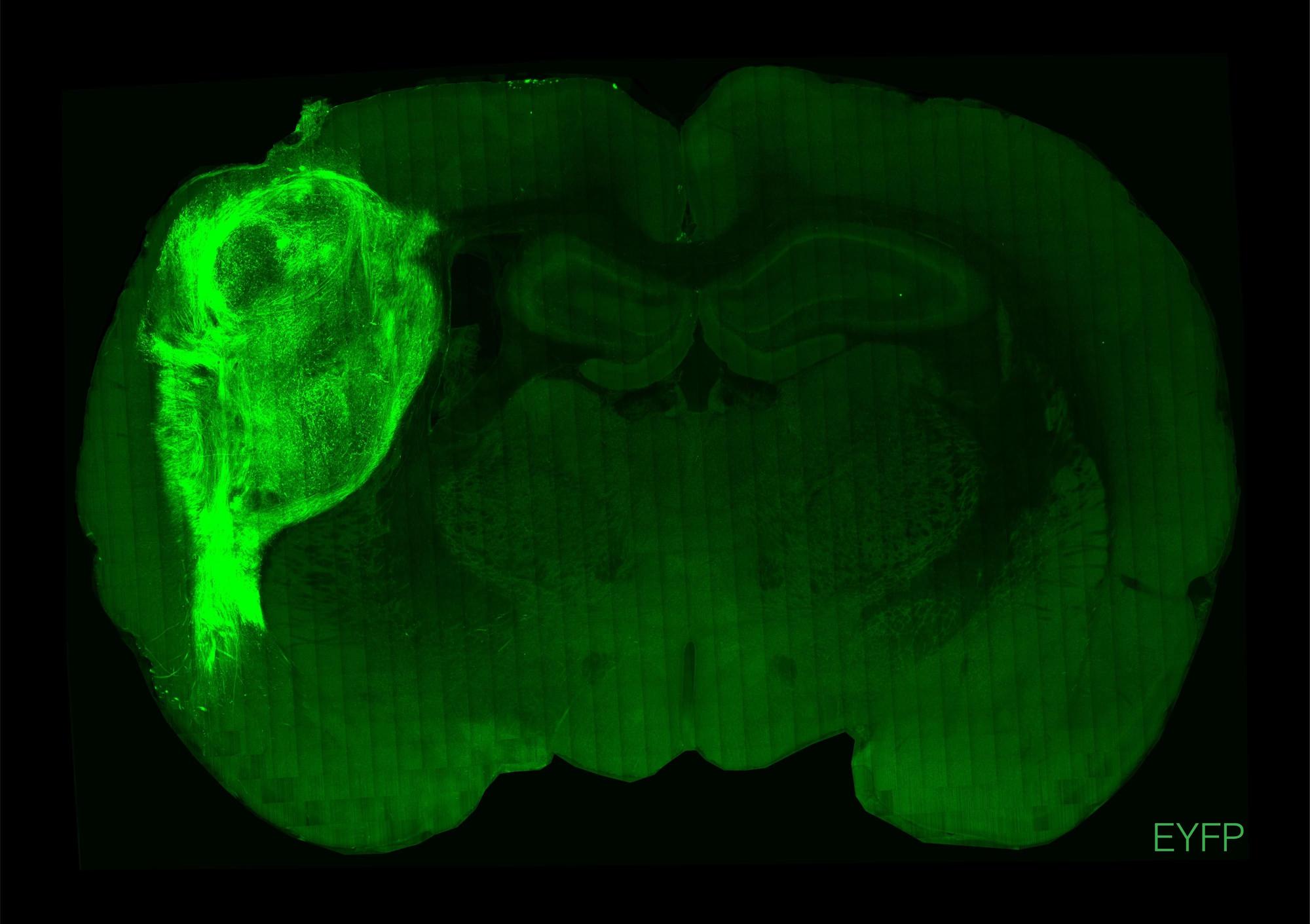 A transplanted human organoid labeled with a fluorescent protein in a section of the rat brain.