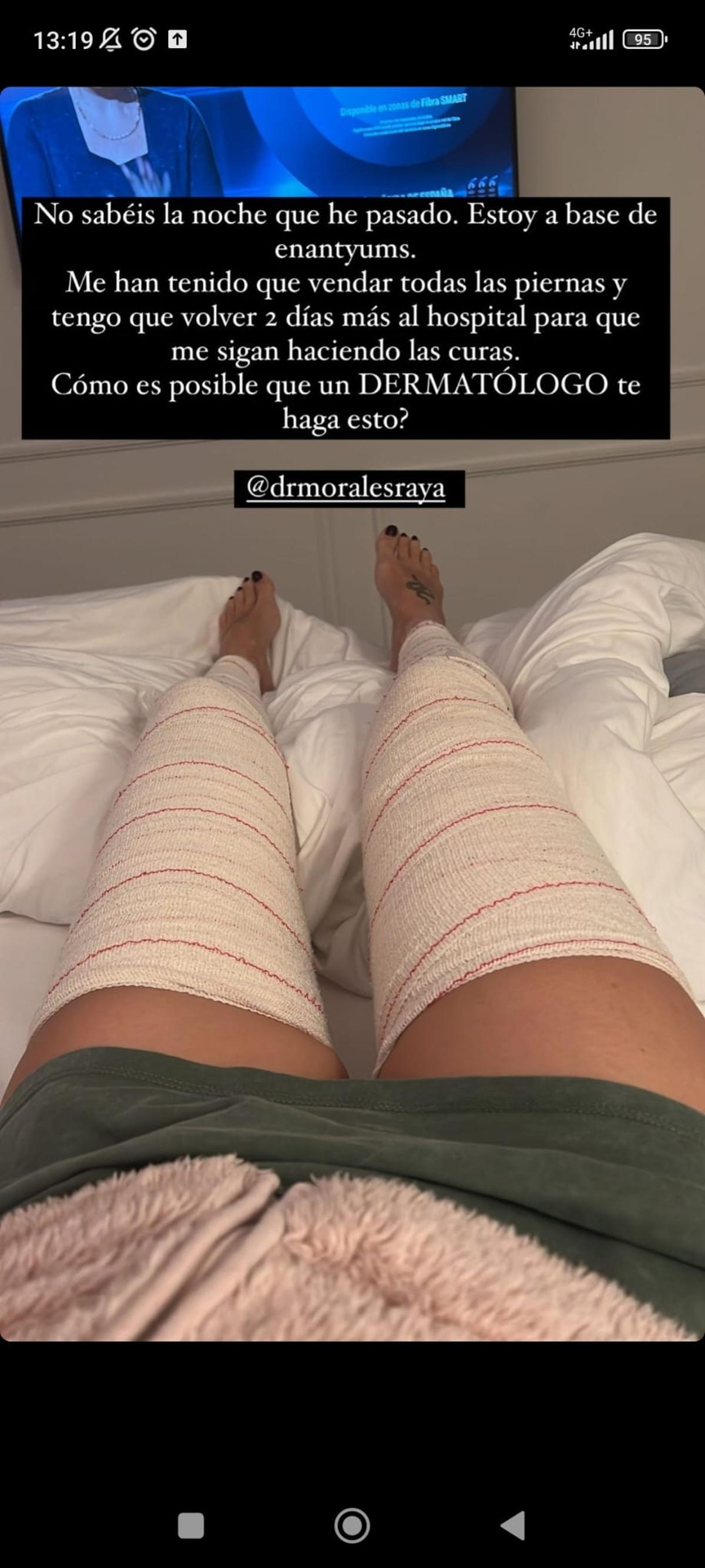 Adara Molinero comparte su estado de salud en Instagram