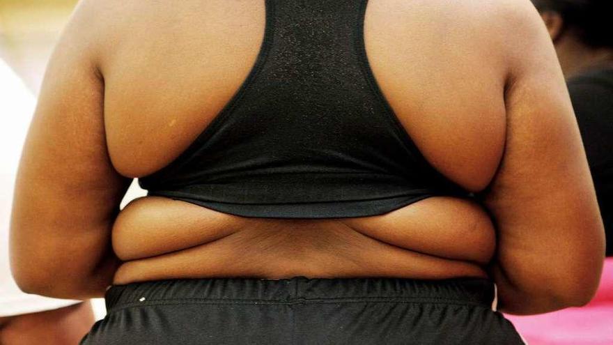 Detalle de la espalda de una mujer con obesidad.