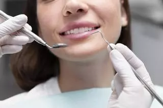 Limpieza dental cada 6 meses: estas son las razones para no dejar de hacerlo