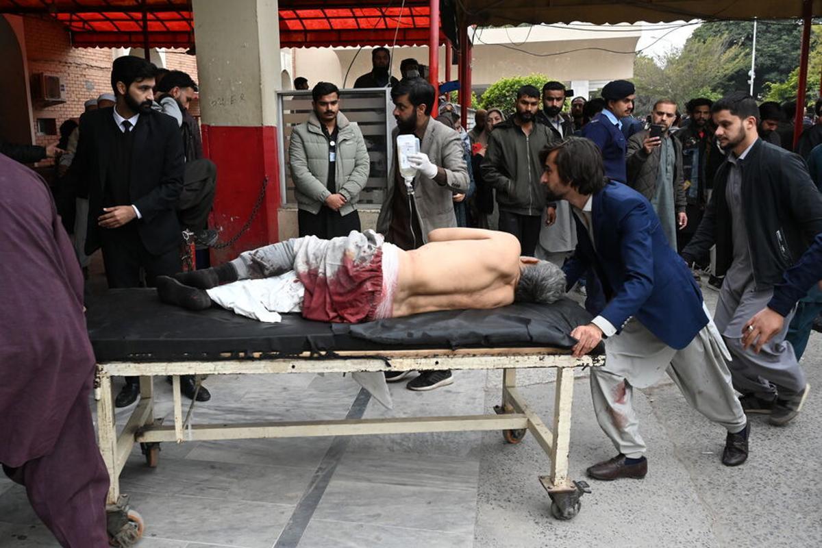 Una de las víctimas en el atentado en Islamabad.