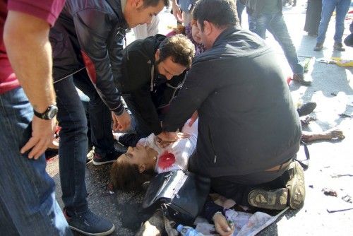 People try to help an injured woman after an explosion during a peace march in Ankara