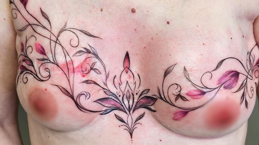 Cicatrices del cáncer de mama se transforman en flores