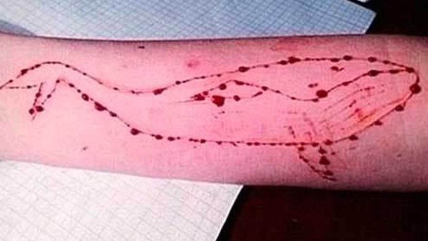 Heridas que se practicó una menor en el brazo asemejando una ballena.