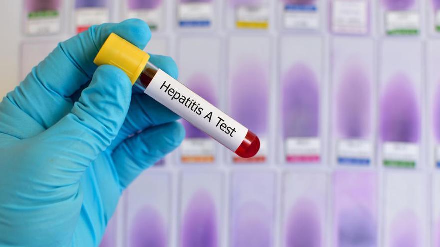 Virus de la Hepatitis A. // Getty