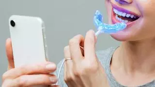 Estos son los riesgos de realizarse un blanqueamiento dental sin supervisión de un dentista