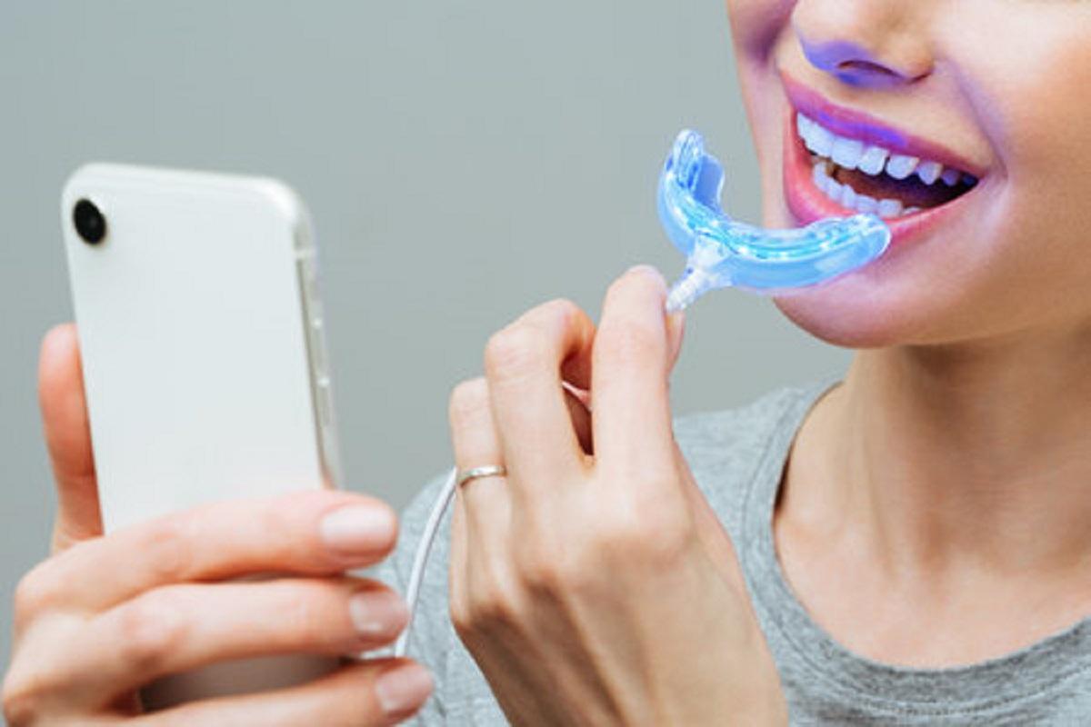 Estos son los riesgos de realizarse un blanqueamiento dental sin supervisión de un dentista.
