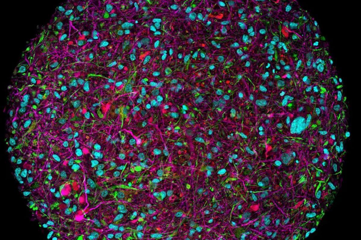 Las células cerebrales cultivadas en laboratorio se están empleando para la informática.