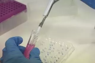 Más allá de la beta-amiloide: la investigación en alzhéimer busca también fármacos contra la inflamación crónica y la proteína tau