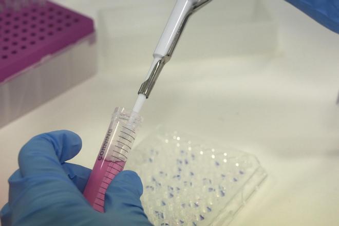 Más allá de la beta-amiloide: la investigación en alzhéimer busca también fármacos contra la inflamación crónica y la proteína tau