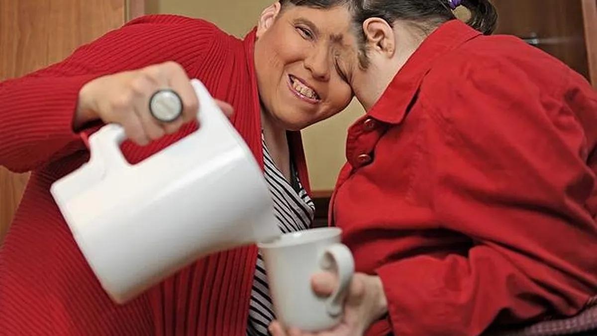 Mueren Lori y George Schappell, los hermanos siameses más viejos del mundo