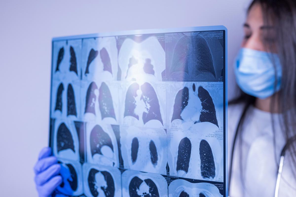 Una sanitaria examina una prueba torácica.