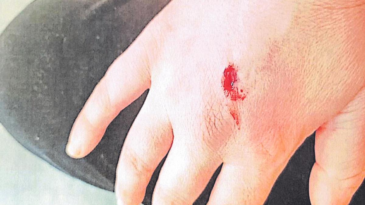 La denuncia incluye la fotografía de una supuesta agresión a la madre, en la mano, con un punzón.