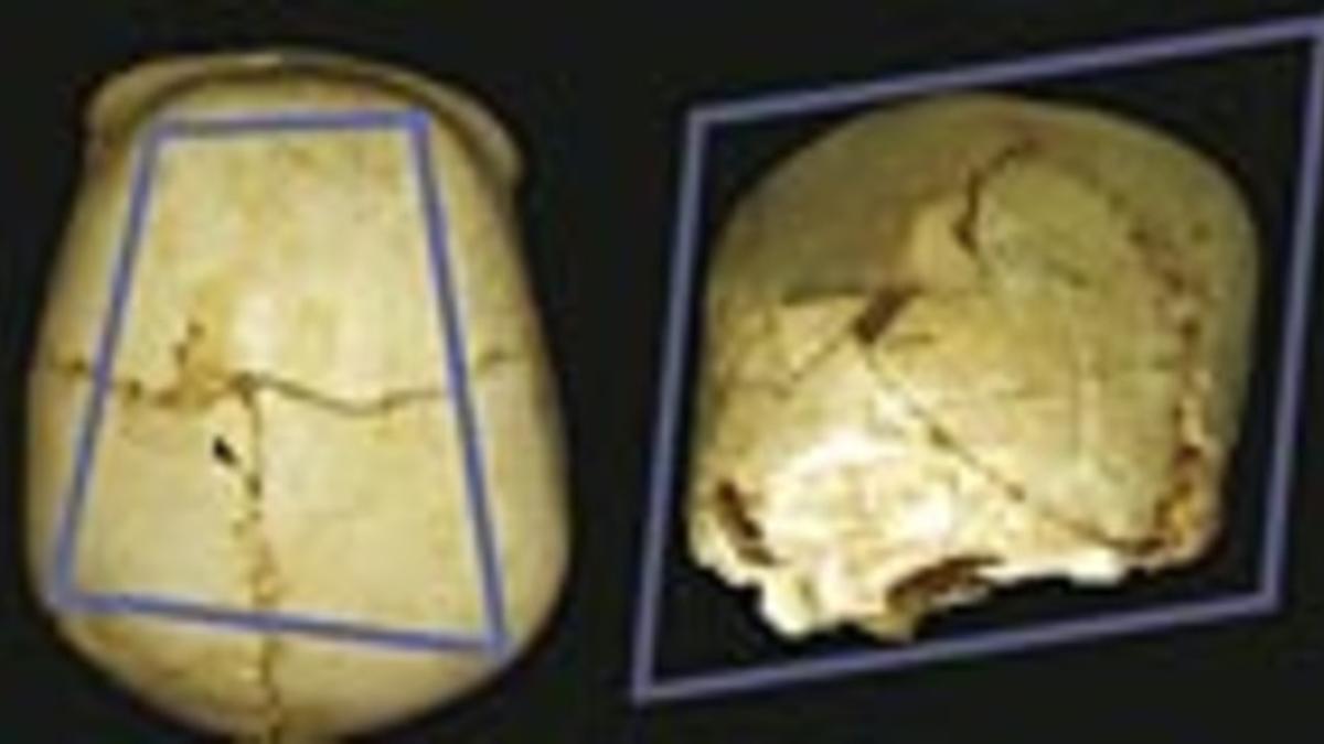 El cráneo del niño con una malformación encontrado en Atapuerca.