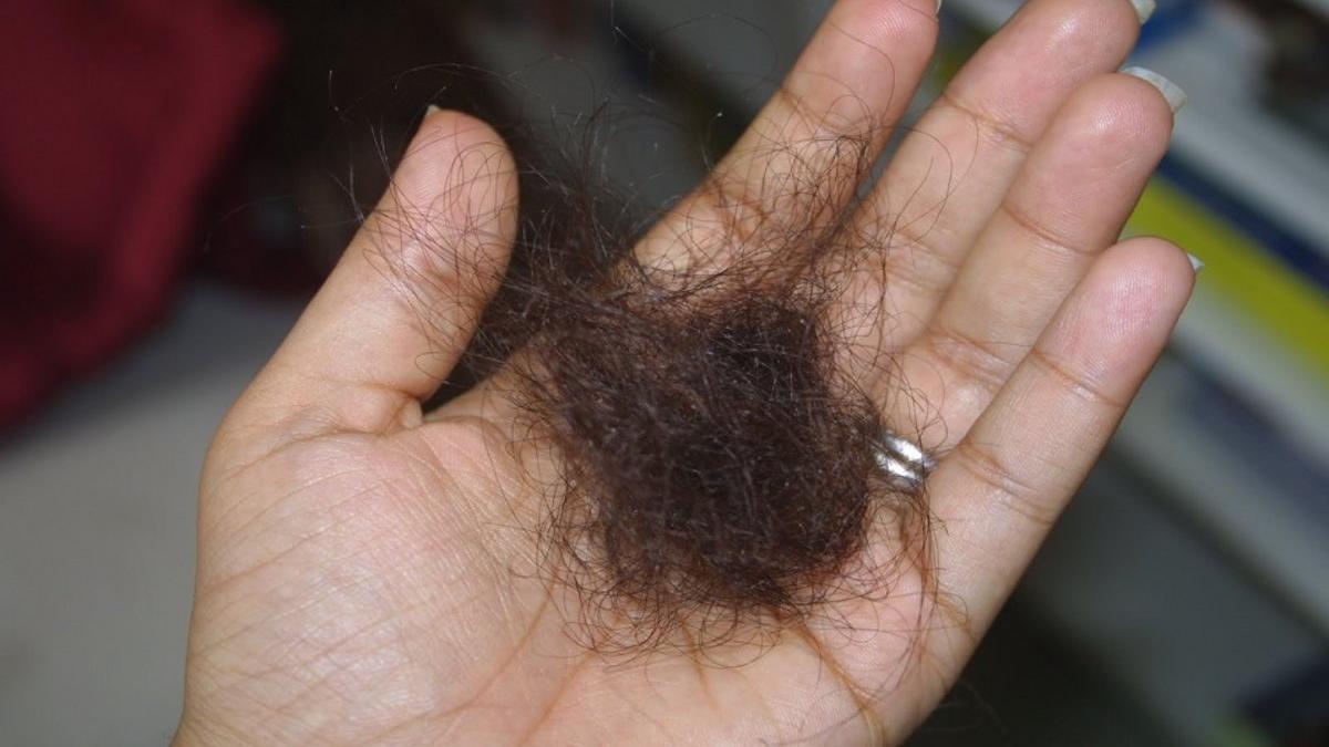 La caída de pelo podría ser uno de los efectos secundarios del coronavirus