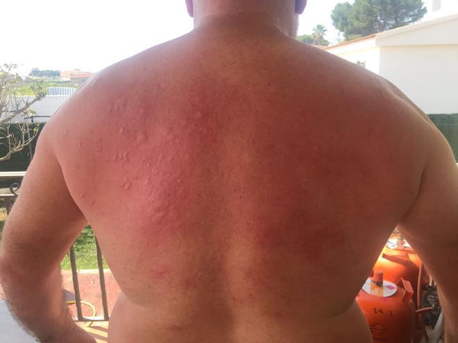"Así no se puede vivir, estamos en mayo y nos comen los mosquitos"