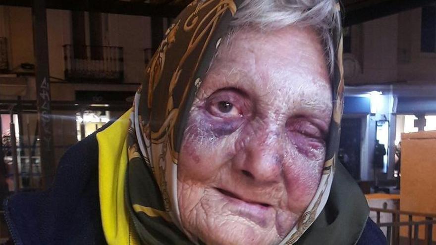 Brutal pallissa a una dona sense llar de 84 anys a Madrid