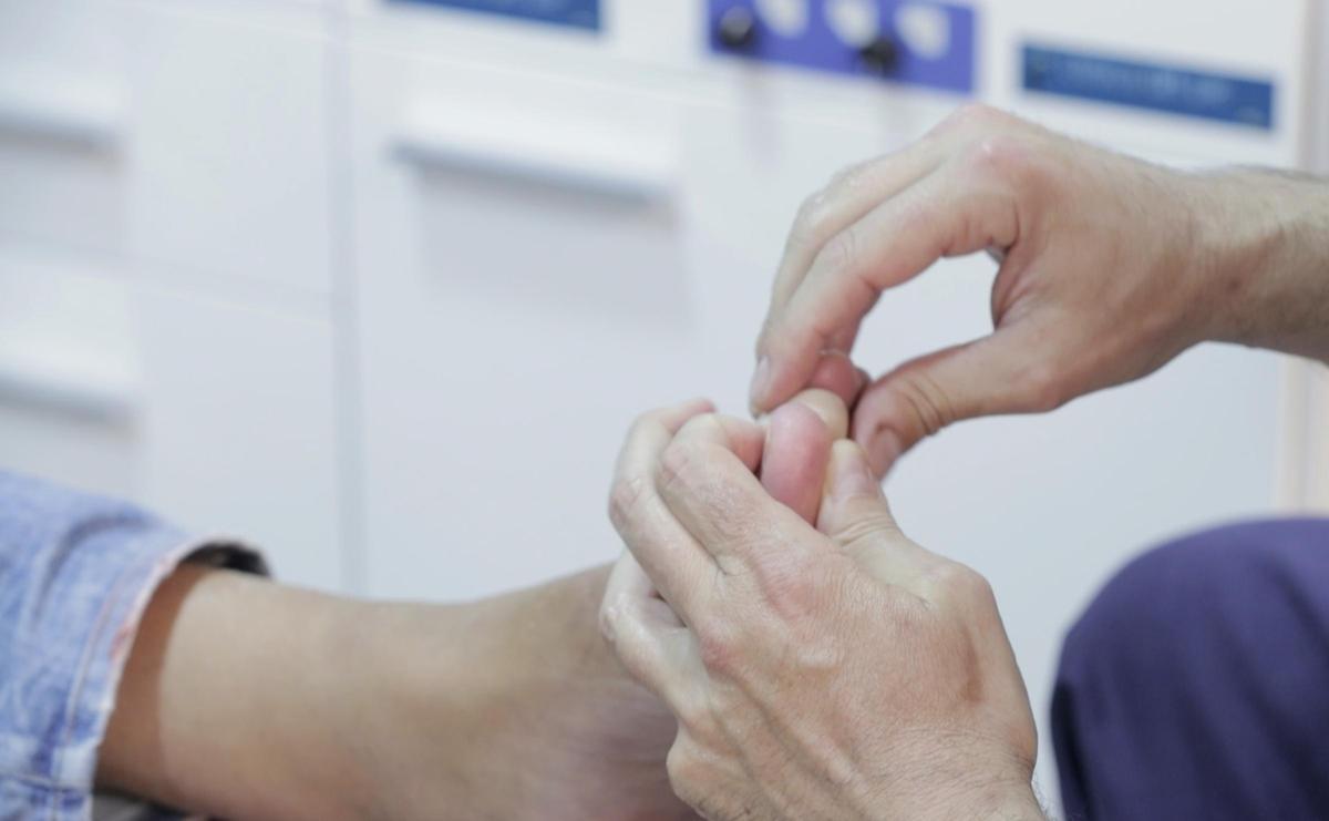 Un podólogo trata la enfermedad de los 'dedos en salchicha' de la que alertan los especialistas valencianos.