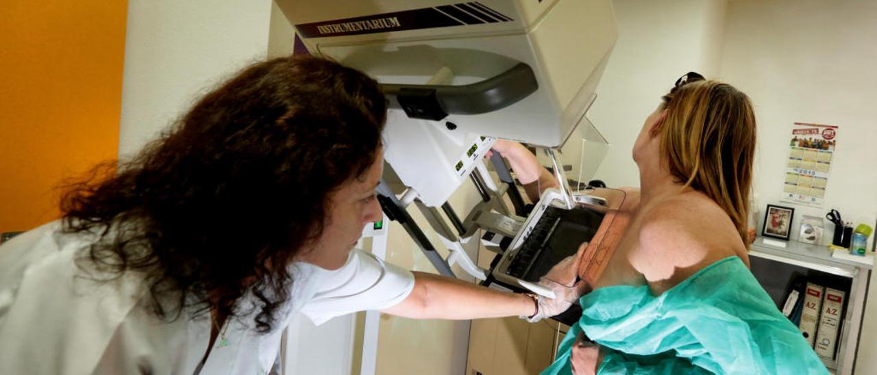 Los médicos insisten en la importancia de las mamografías para detectar el cáncer de mama.