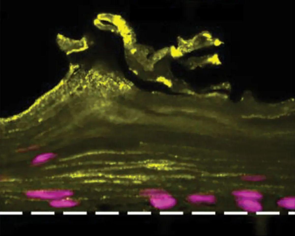 Una “vagina en un chip”, que muestra el epitelio vaginal, el revestimiento interno de la vagina, con distintas capas y estructuras de tejido en amarillo.