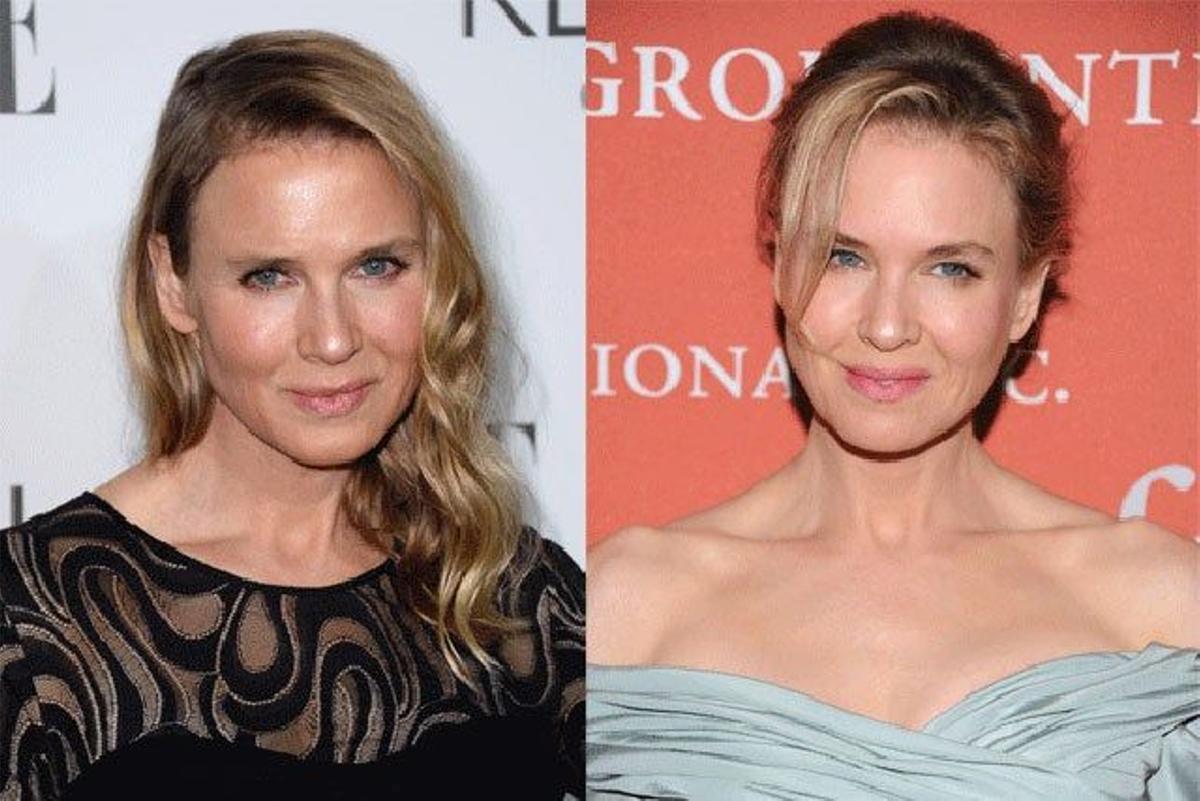 Famosas que han pasado por el quirófano: Renée Zellweger