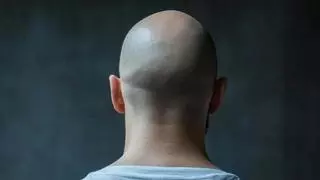 Cuando el LSD y la cocaína se cruzaron con el ungüento milagroso para calvos en Cáceres