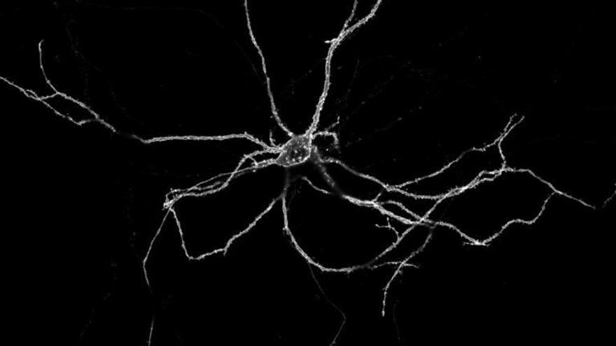 Un zoom sobre las neuronas descubre una cadena cerebral de luces