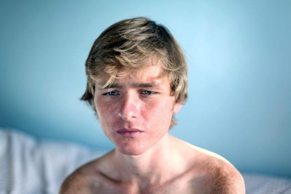 Primer premi en retrat individual. Foto que mostra un adolescent que es diu Graham que té anorèxia.