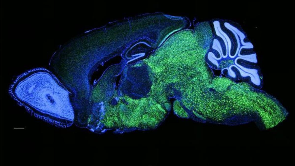 Patrón de expresión de la proteína NOVA1 en el cerebro.