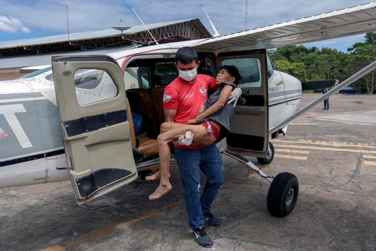 Niño indígenas yanomami desnutridos reciben tratamiento en el Hospital Infantil Santo Antonio en Boa Vista, estado de Roraima, Brasil.